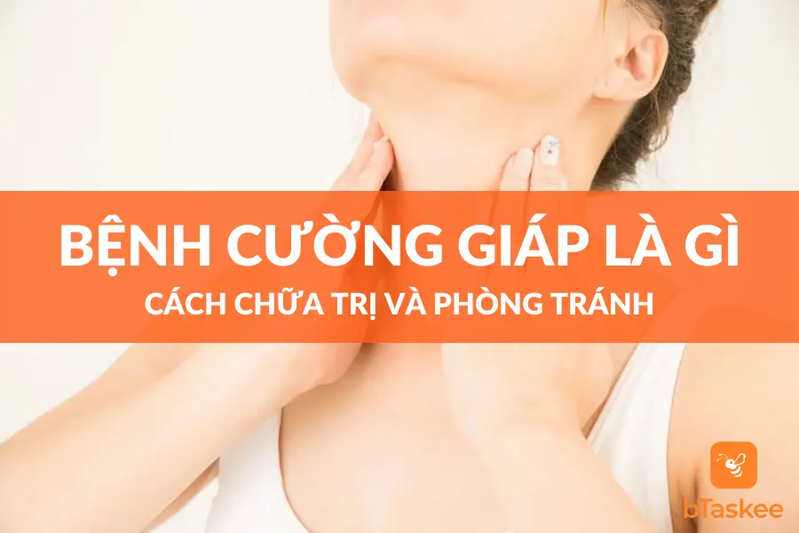 Bệnh Cường Giáp Là Gì? Cách Chữa Trị Và Phòng Tránh