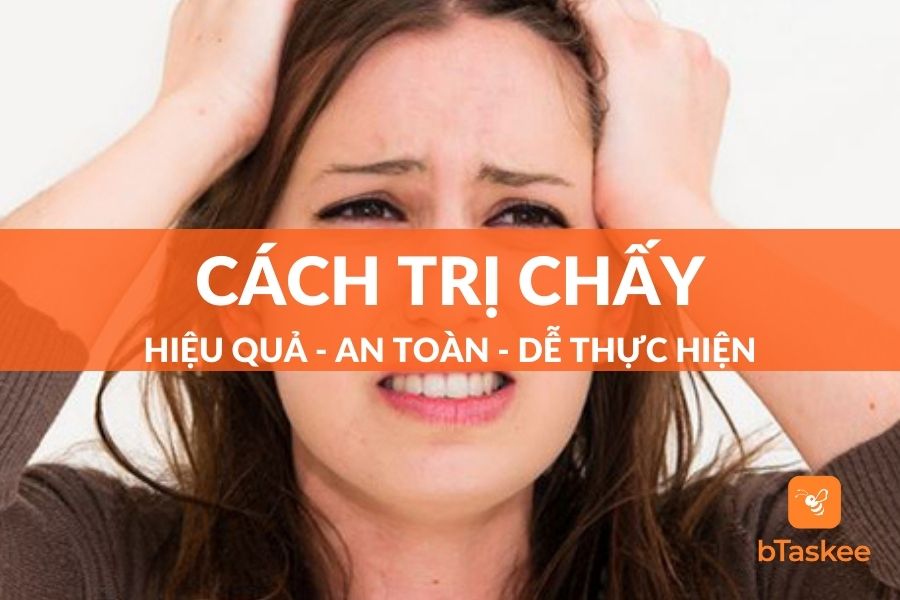 12+ Cách Trị Chấy Đơn Giản Tại Nhà Và Một Số Điều Cần Lưu Ý